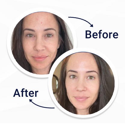 Skin Buff Pad (50ct)